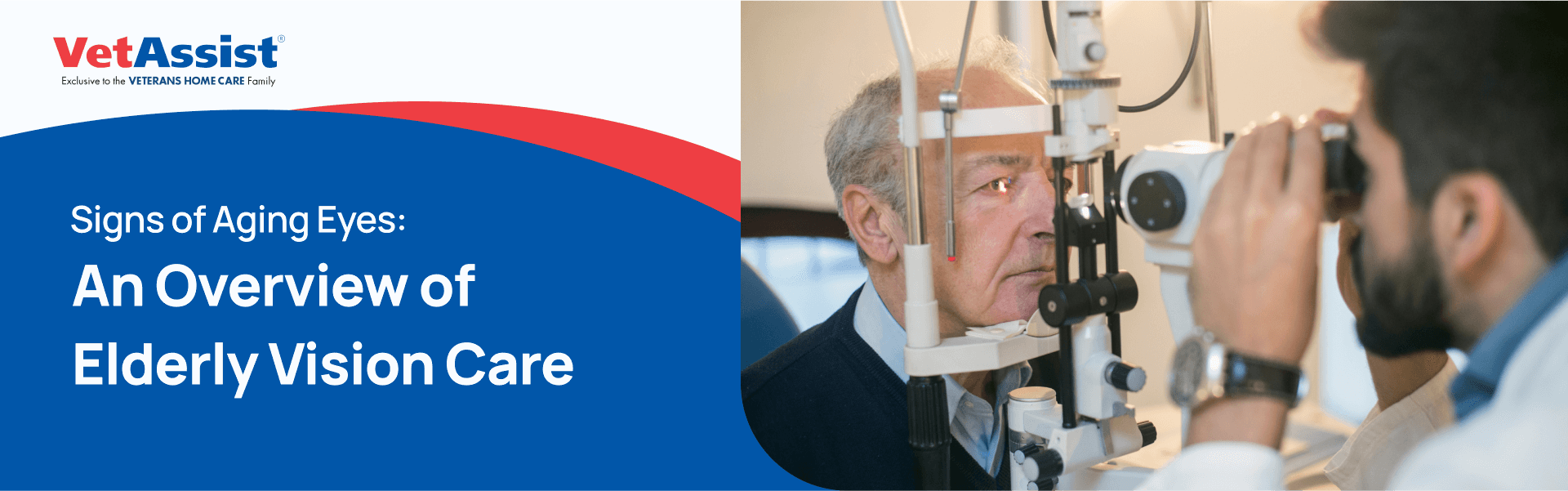 signs of aging eyes